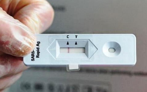 COVID 19 : Tests Antigéniques et Autotests, quand et comment les utiliser ?